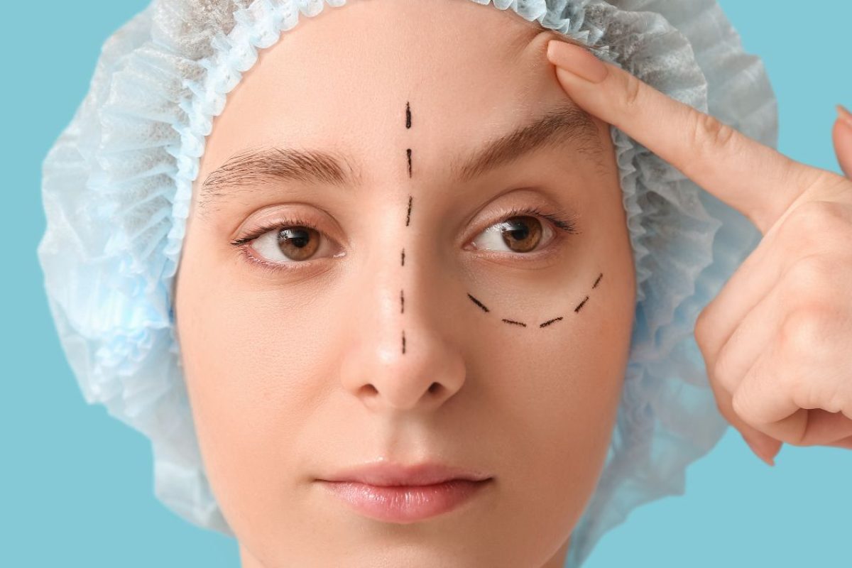 Blefaroplastia