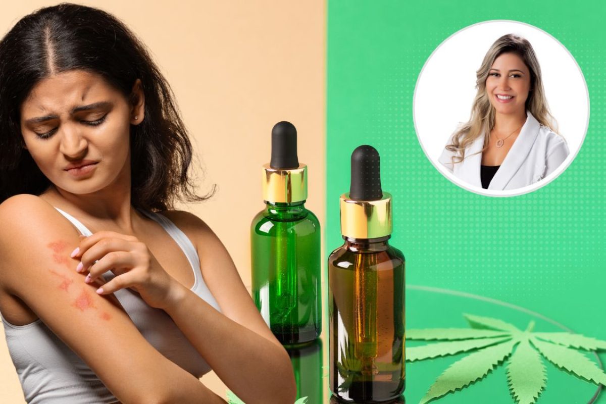 CBD na dermatologia.