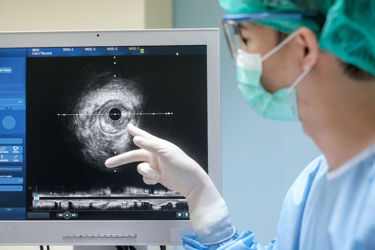 Cateterismo é um exame ou uma cirurgia