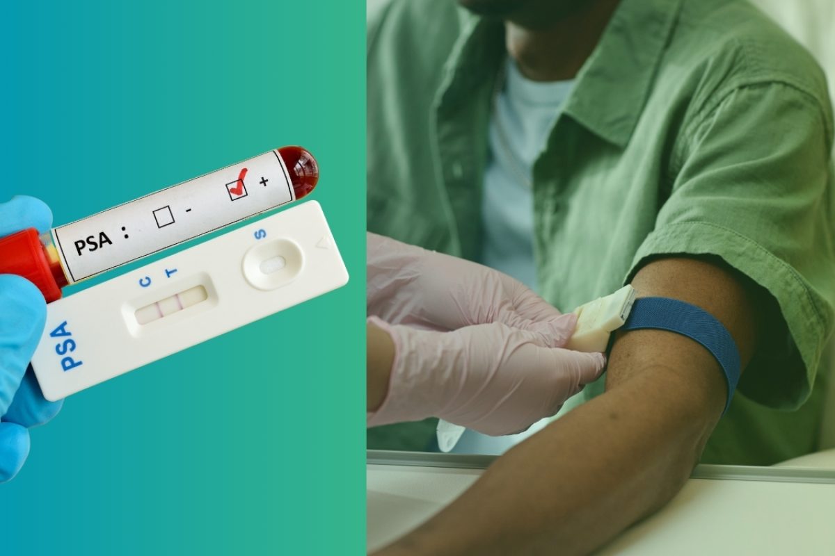 Exame de sangue para próstata