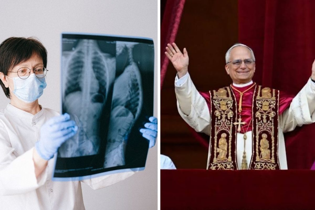 Nódulo pulmonar