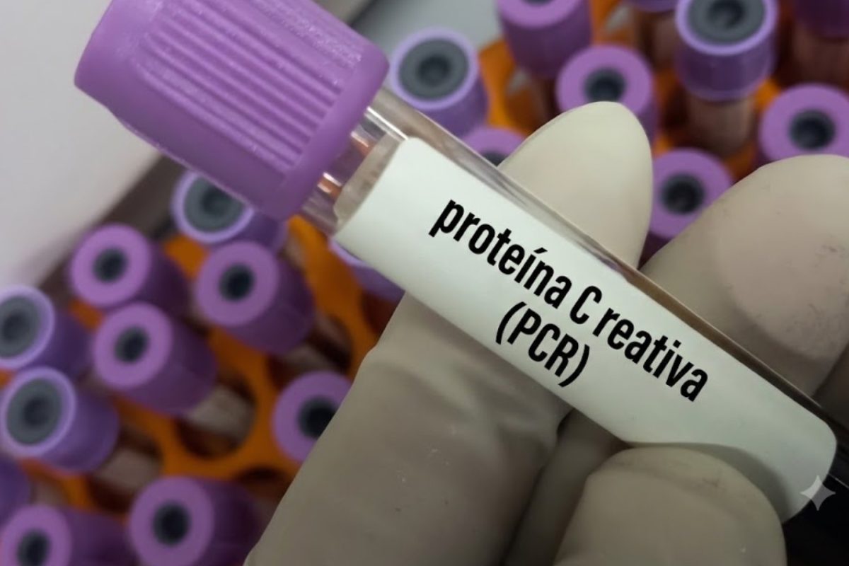 O que é proteína C reativa