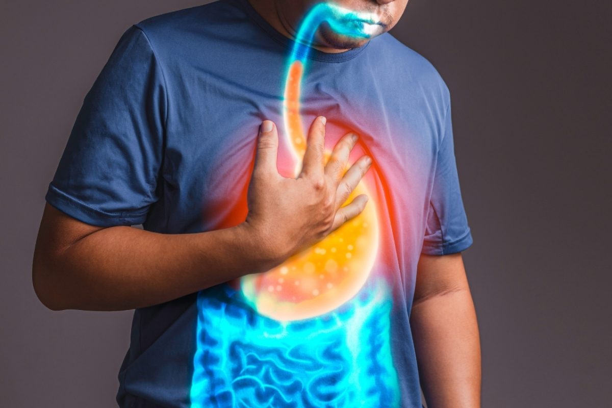Qual a diferença entre refluxo e gastrite