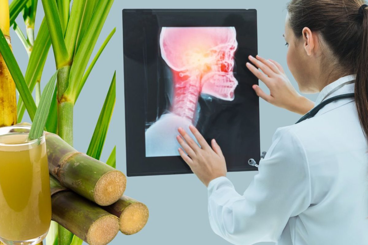 Saliva artificial para câncer de cabeça e pescoço