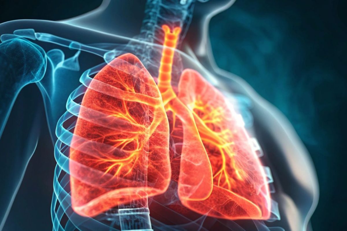 Tuberculose no Brasil.