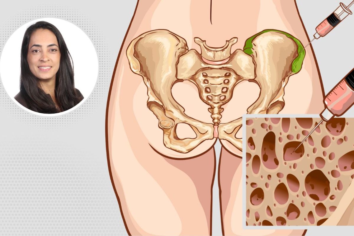 como ser doador de medula óssea.