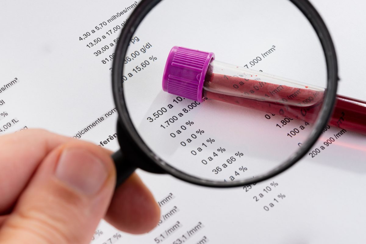 hemograma.