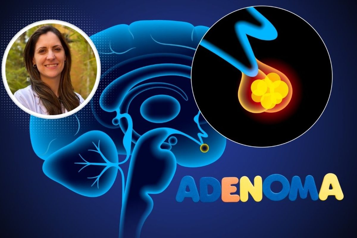 adenoma de hipófise.